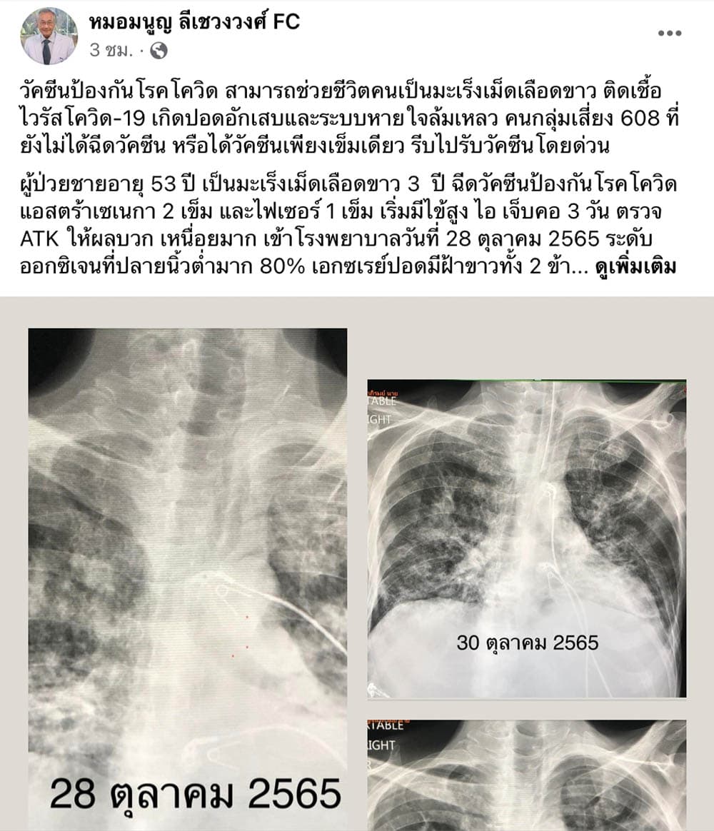 Covid_vaccine_saves_lives_of_leukemia_patients_SPACEBAR_Photo01_cb0b107203.jpeg