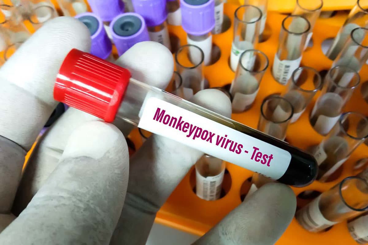 JOY_LIFE_how_to_prevent_monkeypox_virus_SPACEBAR_Photo03_dfe6fbfa53.jpeg