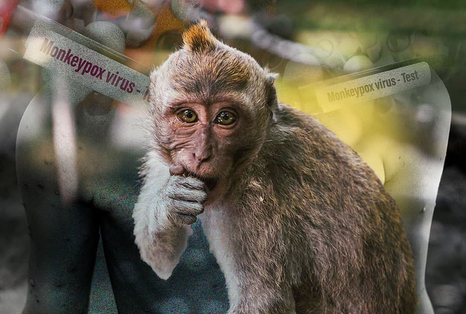 how_to_prevent_monkeypox_virus_SPACEBAR_Thumbnail_10ae88a1ac.jpeg