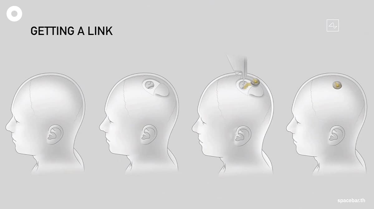 neuralink_elon_Musk_test_brain_implants_people_SPACEBAR_Photo03_30b9924d76.jpeg