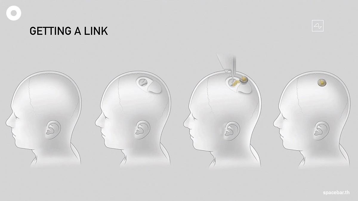 Neuralink-start-human-trial-brain-implant-SPACEBAR-Photo01.jpg