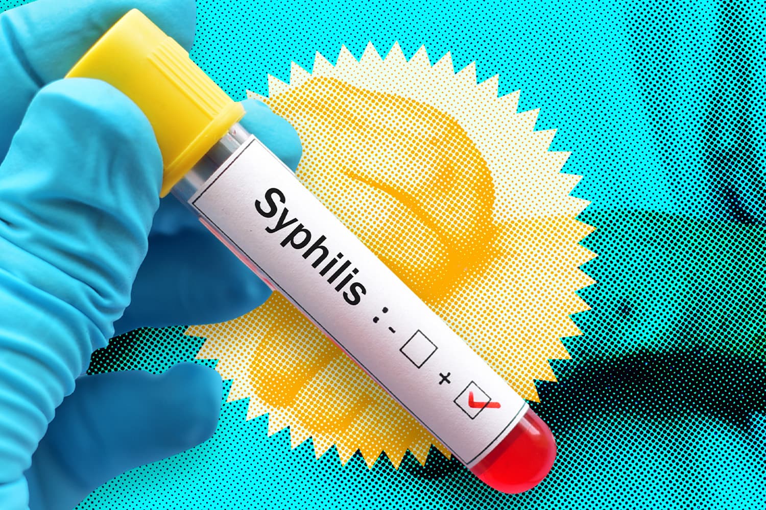 JOY_LIFE_what_is_Syphilis_SPACEBAR_Hero_9f57e17666.jpg