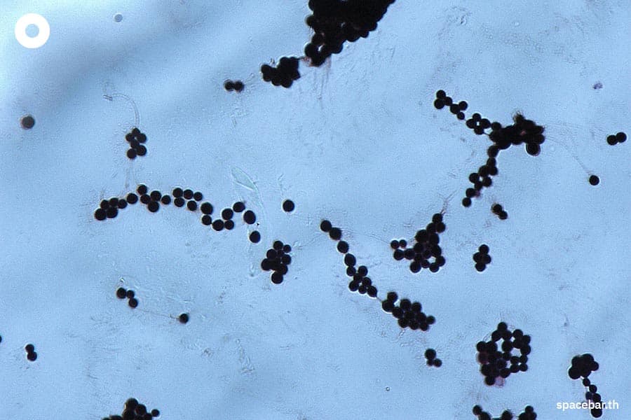 Killer_plant_fungus_Chondrostereum_purpureum_infects_man_in_India_world_first_case_SPACEBAR_Photo02_154e6b02ca.jpeg