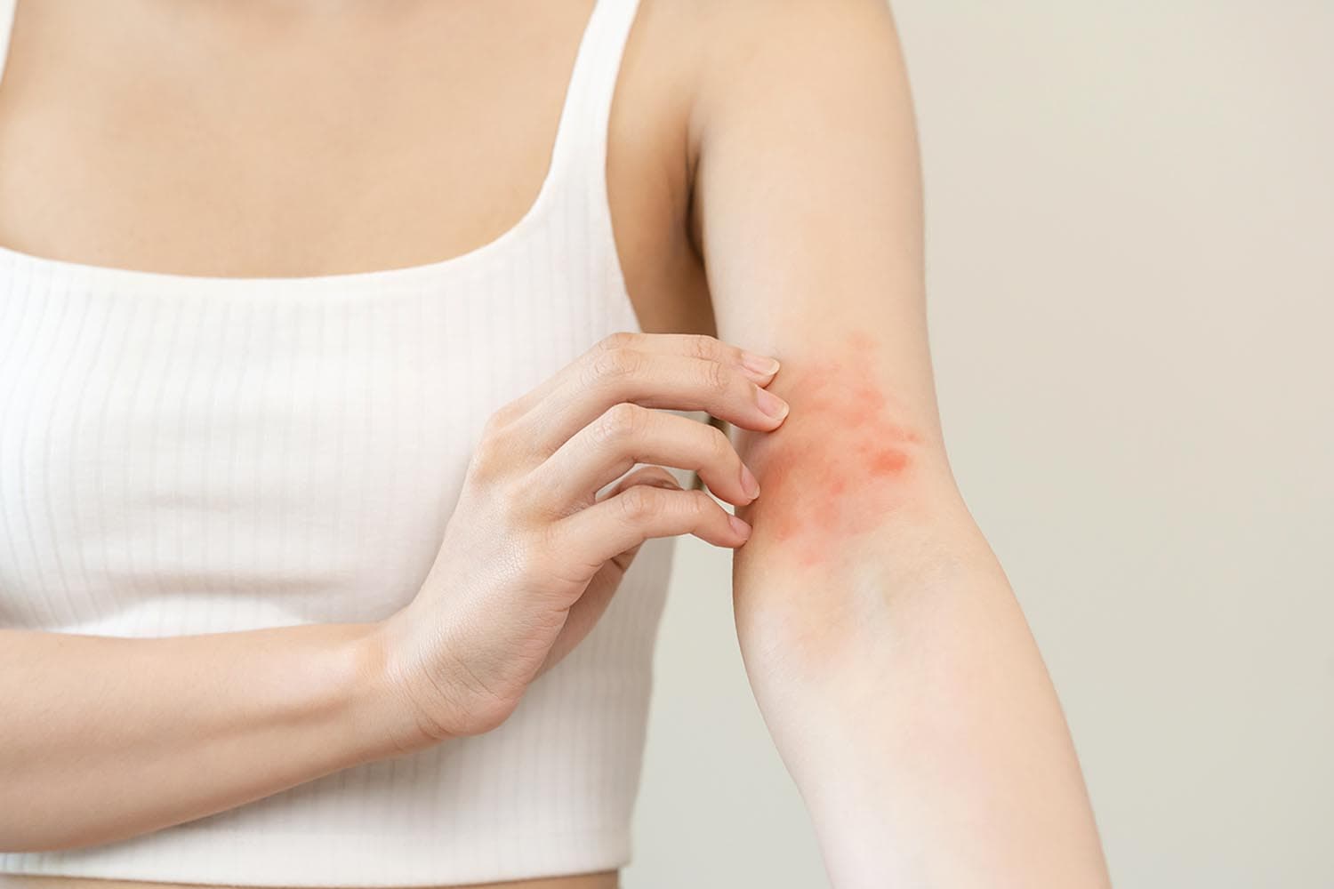 Scientists_analyse_how_climate_change_affect_eczema_skin_condition_SPACEBAR_Hero_49b808fd31.jpg