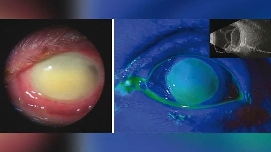 deaths_linked_to_bacteria_in_eye_drops_SPACEBAR_Photo01_72aa149f77.jpeg