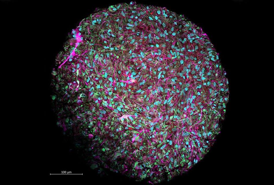 scientists-announce-new-organoid-intelligence-field-SPACEBAR-Thumbnail