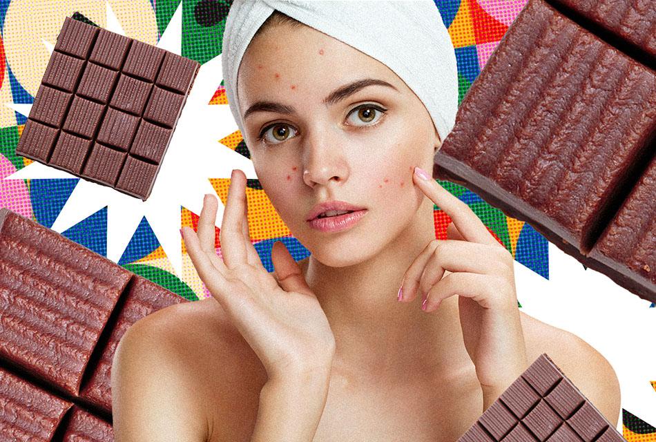 ture-or-not-eating-chocolate-cause-acne-SPACEBAR-Thumbnail
